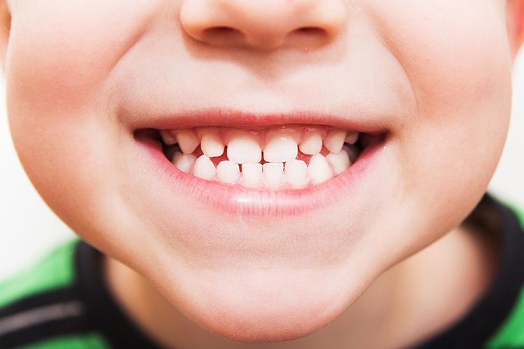 Smiling teeth of a little kid